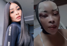 Khanyi Mbau buys a brand new face for herself: From Bleaching to Blepharoplasty (WATCH VIDEO)