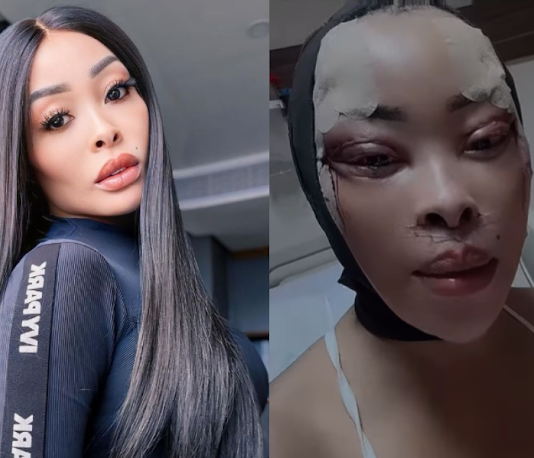 Khanyi Mbau buys a brand new face for herself: From Bleaching to Blepharoplasty (WATCH VIDEO)