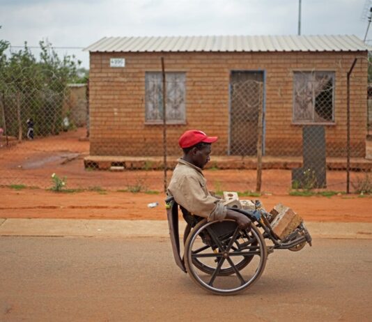 I wish I had died in that accident: Meet Zama Zama who lost his legs and now lives a ruthless life