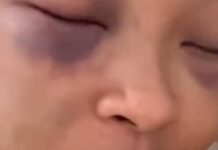 No more tlof tlof for him: Social media influencer and DJ Cyan Boujee speaks out after being thorough bashed by her ex-boyfriend (VIDEO)