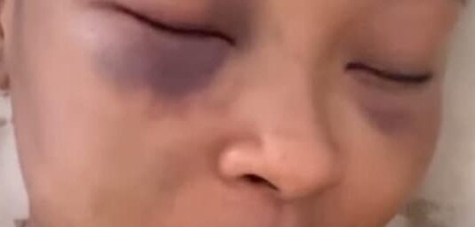 No more tlof tlof for him: Social media influencer and DJ Cyan Boujee speaks out after being thorough bashed by her ex-boyfriend (VIDEO)