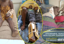 Survivors of Beitbridge accident transferred to Harare as images of injured victims in 'cardboard casts' go viral and break the internet