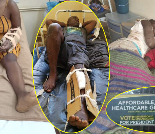 Survivors of Beitbridge accident transferred to Harare as images of injured victims in 'cardboard casts' go viral and break the internet