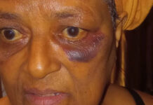 Taking too long in toilet gets gogo thoroughly bashed: "I was never beaten and kicked like this in my entire 66 years"