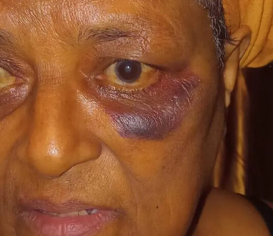 Taking too long in toilet gets gogo thoroughly bashed: "I was never beaten and kicked like this in my entire 66 years"
