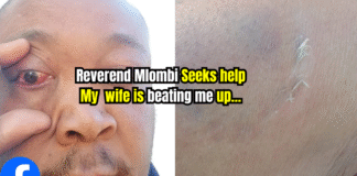 Reality Star Reverend Mlombi Thoroughly Beaten up by Wife, Family Appeals for Help