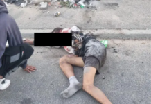 Man Lucky to Be Alive After Stabbing and Being Set Alight in Cape Town