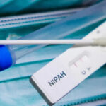 Health Department Urges Calm Amid Nipah Virus Concerns