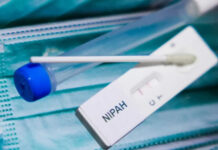 Health Department Urges Calm Amid Nipah Virus Concerns