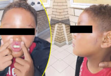 Mitchell's Plain Boy (10) Left Unrecognisable After Being Brutally Beaten by Uncle for Disrespecting Grandma, Slapped 20 TIMES