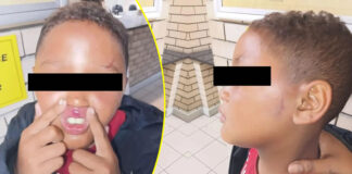 Mitchell's Plain Boy (10) Left Unrecognisable After Being Brutally Beaten by Uncle for Disrespecting Grandma, Slapped 20 TIMES