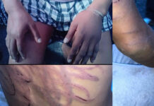 "THEY TORTURED MY SON": Cape Town Mom's Horror as Soldiers Beat Son While Cops Smoke Cigarettes