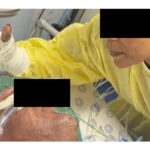 Heartbreaking Story Of The Eight Year Old Boy And His Father Facing A Long And Painful Recovery After House Fire