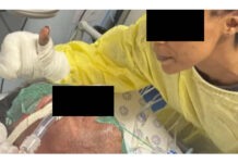 Heartbreaking Story Of The Eight Year Old Boy And His Father Facing A Long And Painful Recovery After House Fire