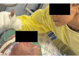 Heartbreaking Story Of The Eight Year Old Boy And His Father Facing A Long And Painful Recovery After House Fire