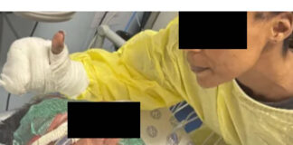 Heartbreaking Story Of The Eight Year Old Boy And His Father Facing A Long And Painful Recovery After House Fire