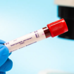 High-Security Lockdown: Health Dept to Reveal Status of British Tourist in Joburg Hantavirus Crisis