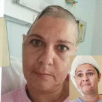 Quad Bike Horror: "I Should've Been Dead" – The Woman with a Hole in Her Head: Melissa Mostert's Miraculous Survival Story!