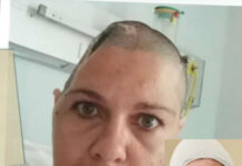 Quad Bike Horror: "I Should've Been Dead" – The Woman with a Hole in Her Head: Melissa Mostert's Miraculous Survival Story!