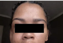 ‘Jesus Saved My Life’: Woman Survives Cement Block Attack on N2 “Hell Run”