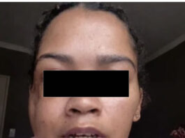 ‘Jesus Saved My Life’: Woman Survives Cement Block Attack on N2 “Hell Run”