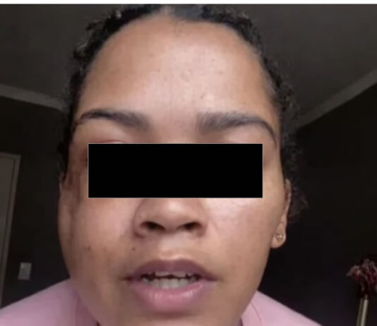 ‘Jesus Saved My Life’: Woman Survives Cement Block Attack on N2 “Hell Run”