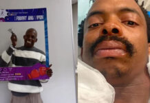 Actor Sabelo Gumede Beats Rare Cancer Only To Face R500,000 Medical Debt