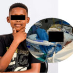 He walked through an open gate to fetch his brother — then five German Shepherds mauled him Boy (12) loses both ears and his lower lip in brutal dog attack