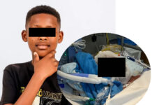He walked through an open gate to fetch his brother — then five German Shepherds mauled him Boy (12) loses both ears and his lower lip in brutal dog attack