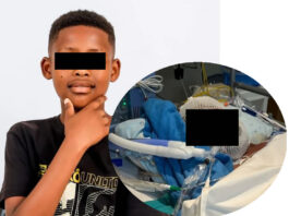 He walked through an open gate to fetch his brother — then five German Shepherds mauled him Boy (12) loses both ears and his lower lip in brutal dog attack