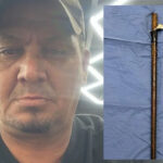 Doctors Save Bellville Man After Massive Steel Rod Enters His Armpit and Exits Near Shoulder