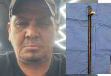 Doctors Save Bellville Man After Massive Steel Rod Enters His Armpit and Exits Near Shoulder