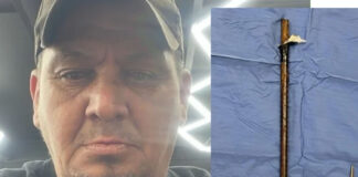 Doctors Save Bellville Man After Massive Steel Rod Enters His Armpit and Exits Near Shoulder