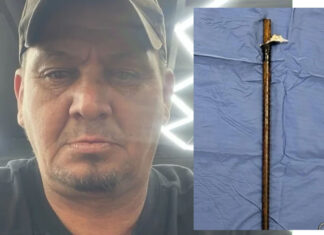 Doctors Save Bellville Man After Massive Steel Rod Enters His Armpit and Exits Near Shoulder