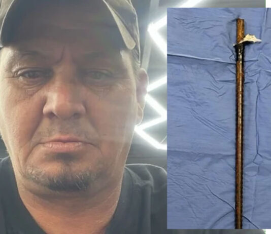 Doctors Save Bellville Man After Massive Steel Rod Enters His Armpit and Exits Near Shoulder