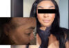‘I am bruised, hurting and shaken’: Holiday turns frightening at Fourways hotel as woman alleges assault after rejecting unwanted advances
