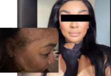 ‘I am bruised, hurting and shaken’: Holiday turns frightening at Fourways hotel as woman alleges assault after rejecting unwanted advances