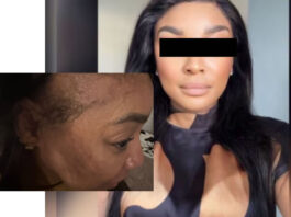 ‘I am bruised, hurting and shaken’: Holiday turns frightening at Fourways hotel as woman alleges assault after rejecting unwanted advances