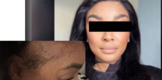 ‘I am bruised, hurting and shaken’: Holiday turns frightening at Fourways hotel as woman alleges assault after rejecting unwanted advances