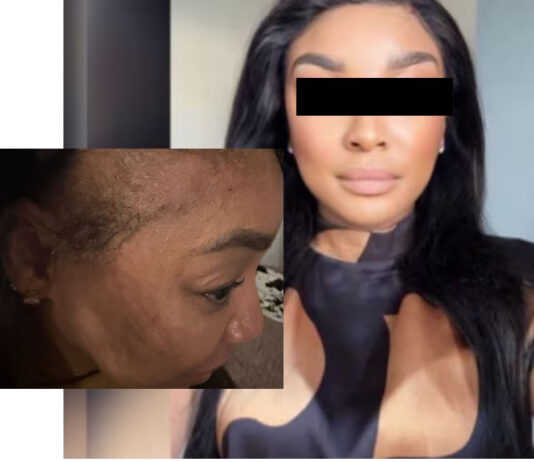 ‘I am bruised, hurting and shaken’: Holiday turns frightening at Fourways hotel as woman alleges assault after rejecting unwanted advances