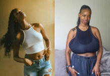 Months After A Terrifying R150,000 Reduction – This 26-Year-Old’s Breasts Have Rapidly Grown Back Again