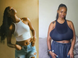 Months After A Terrifying R150,000 Reduction – This 26-Year-Old’s Breasts Have Rapidly Grown Back Again