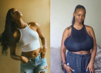 Months After A Terrifying R150,000 Reduction – This 26-Year-Old’s Breasts Have Rapidly Grown Back Again